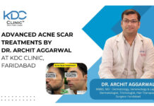 Advanced Acne Scar Treatments by Dr. Archit Aggarwal at KDC Clinic, Faridabad
