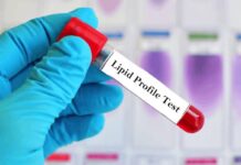 Why Regular Lipid Profile Tests Are Crucial for Heart Health